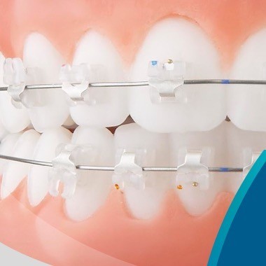 01 Autoligado Estético