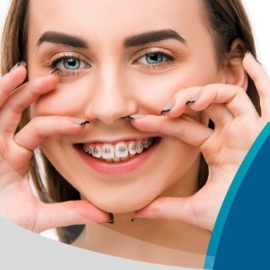 03 Brackets Metálicos